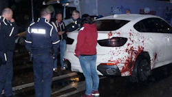 Don't worry, it's not real. The blood spatter is just a decal. It turned out to be realistic enough to fool police, though, who understandbly pulled the car over.