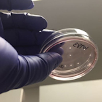brain_organoids_in_a_petri_dish-muotri_lab_-_photo_credit_UC_San_Diego_Health_Sciences
